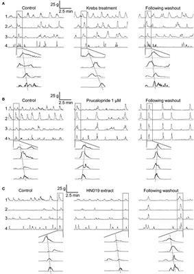 Promotility Action of the Probiotic Bifidobacterium lactis HN019 Extract Compared with Prucalopride in Isolated Rat Large Intestine